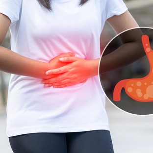 Gyomorégés, reflux esetén ezeket az ételeket mindenképp kerülje!