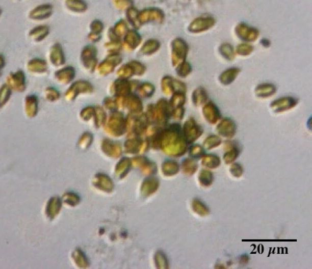 Złote algi pod mikroskopem. Widzianą tutaj gromadkę można byłoby przykryć ludzkim włosem