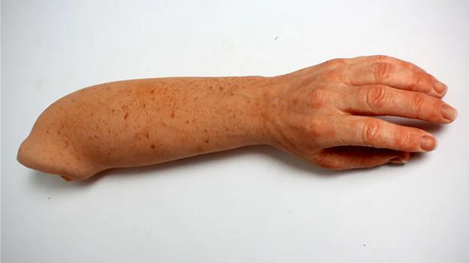 Nadrealno: Za one koji to žele, veštački udovi se proizvode i sa pegama i naborima