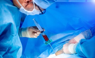 Czy wydatek na zabieg artroskopii stanowi koszt uzyskania przychodu w działalności gospodarczej?