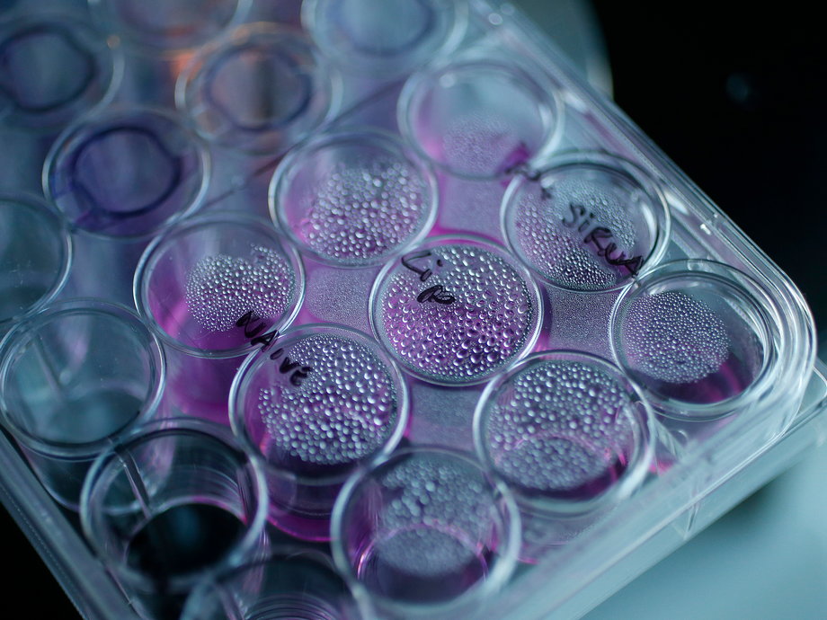 A tray containing cancer cells sitting on an optical microscope in the Nanomedicine Lab at UCL's School of Pharmacy in London.