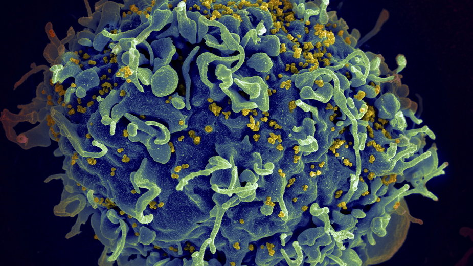 Komórka zaatakowana przez HIV