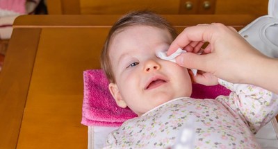 Domowe Sposoby Na Zapalenie Spojowek U Dziecka Mamotoja Pl