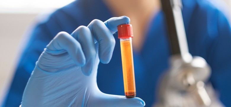 MZ: Czas oczekiwania na wyniki testów znacznie się skróci