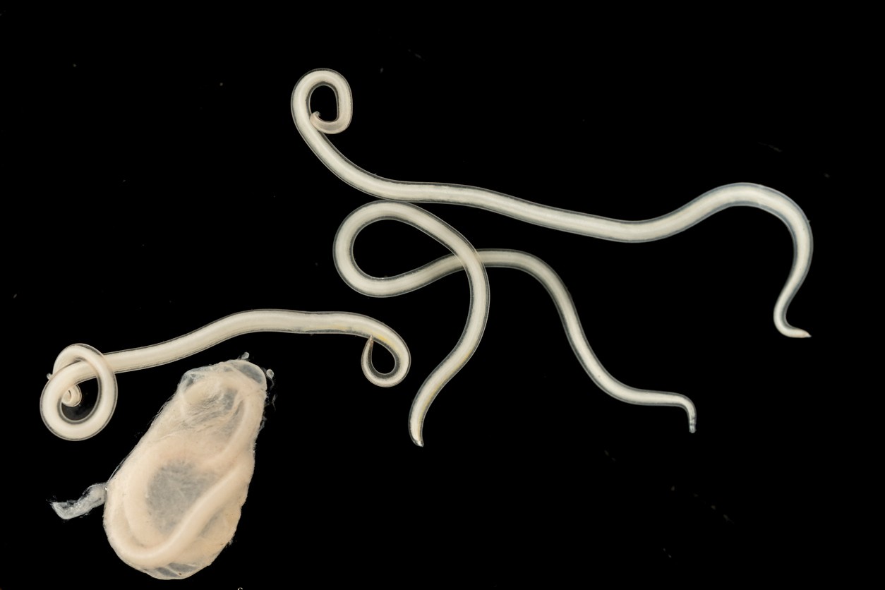 Doctors discovered that the woman had a tapeworm in her brain. (illustrative photo)