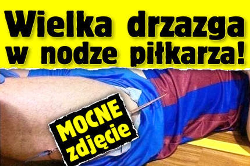 Wielka drzazga w nodze piłkarza! MOCNE zdjęcie