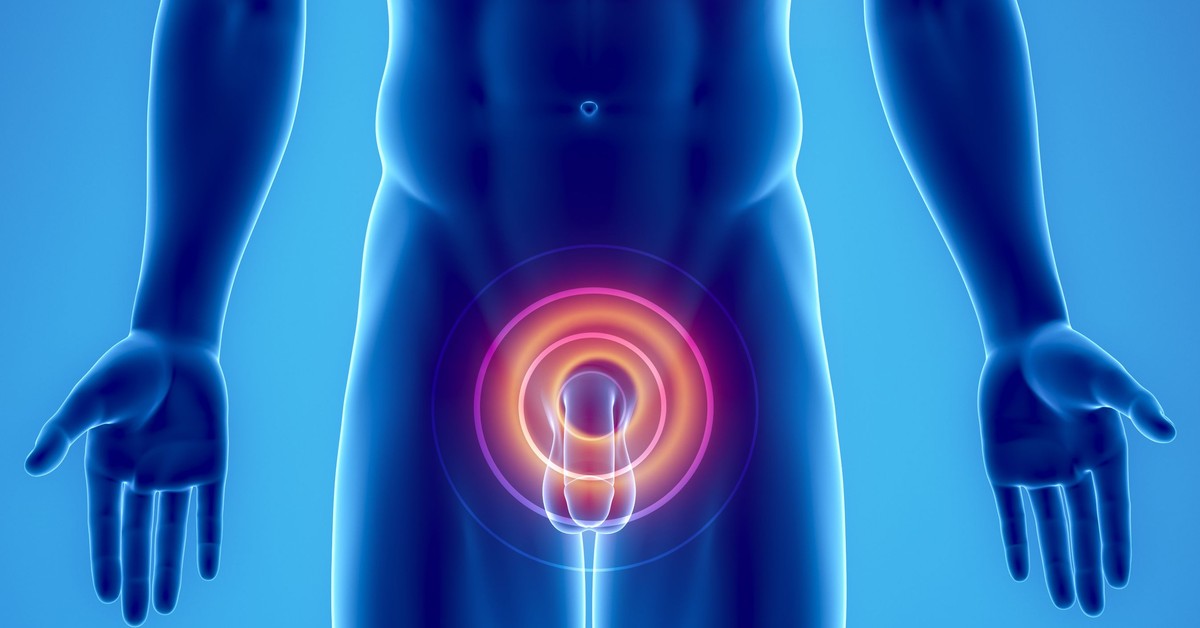 Медицина простата. Магнитотерапия простатит. Магнитотерапия на промежность. Простатит рисунок.