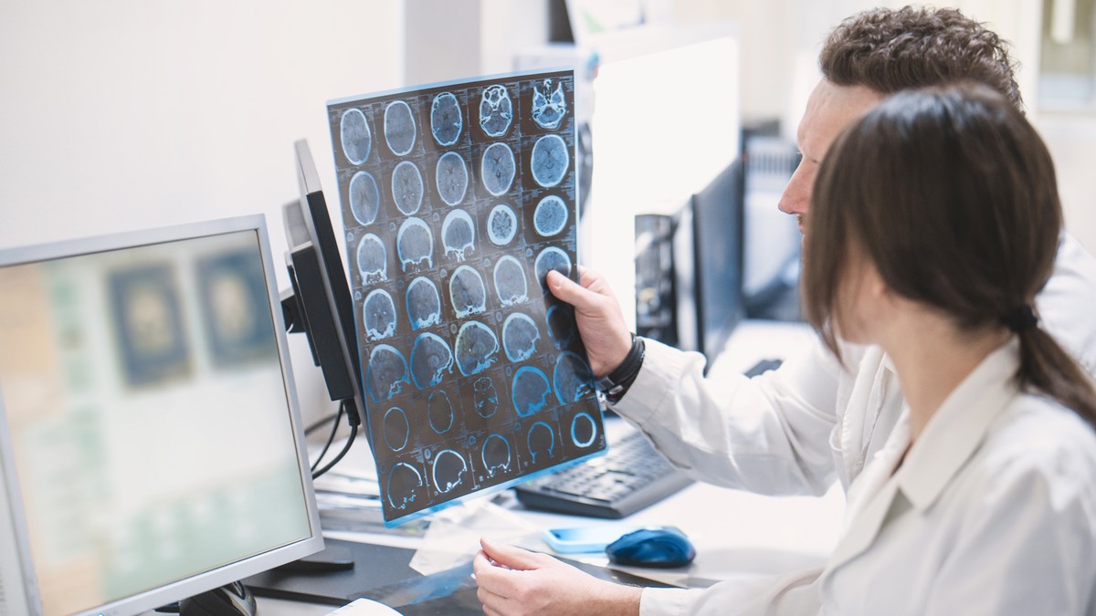 Rredak, ali težak oblik dečje epilepsije uzrokovan je pojedinačnom mutacijom na SCN2A genu
