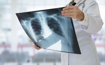 köhögés tüdőgyulladás hőemelkedés láz nehézlégzés
