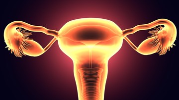 PCOS: a petesejtek termelődését is befolyásolja