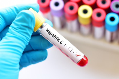A hepatitis C vírus tünetei: korai diagnózis, teljes gyógyulás