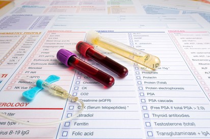 Mit mutat meg a vérkép? Ezekről árulkodnak a biomarkerek