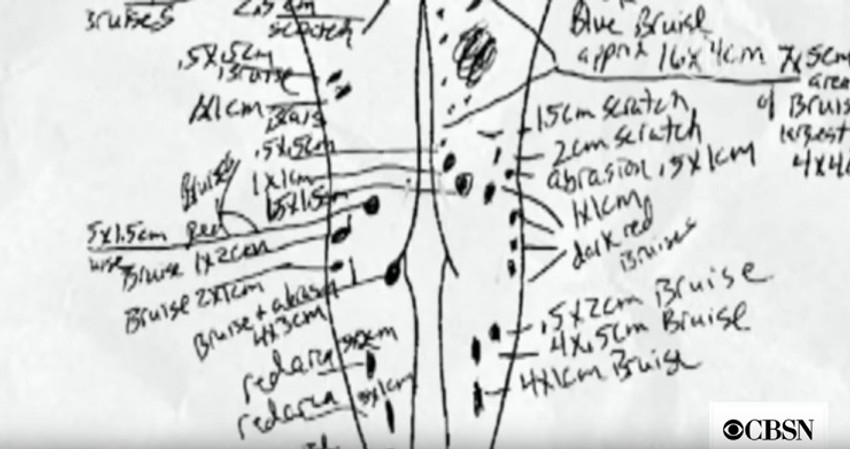 Povreda nije bilo samo na pozadini nogu i temenu