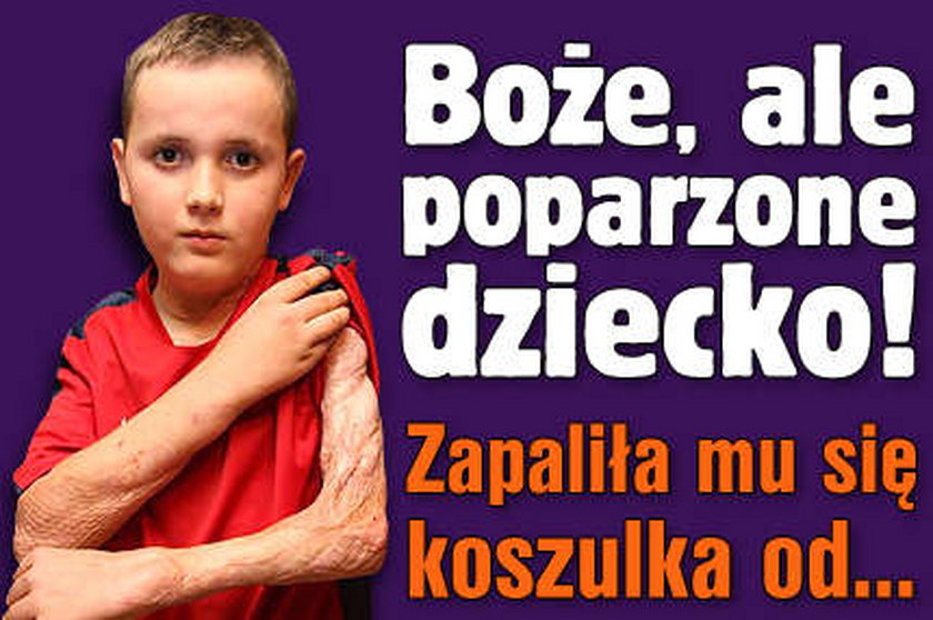 Boże, ale poparzone dziecko! Zapaliła mu się koszulka od ...