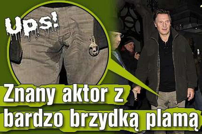 Ups! Znany aktor z bardzo brzydką plamą