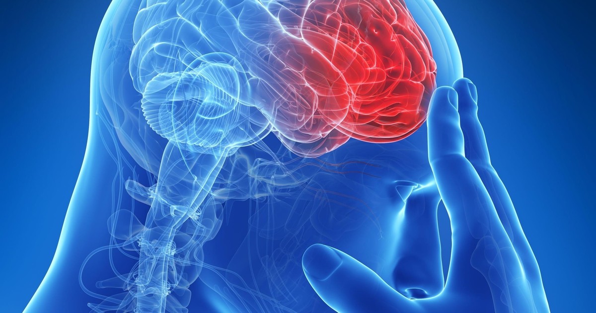 Udar mózgu zabija co minutę miliony komórek. Neurolog tłumaczy krok po kroku, jak szybko działać