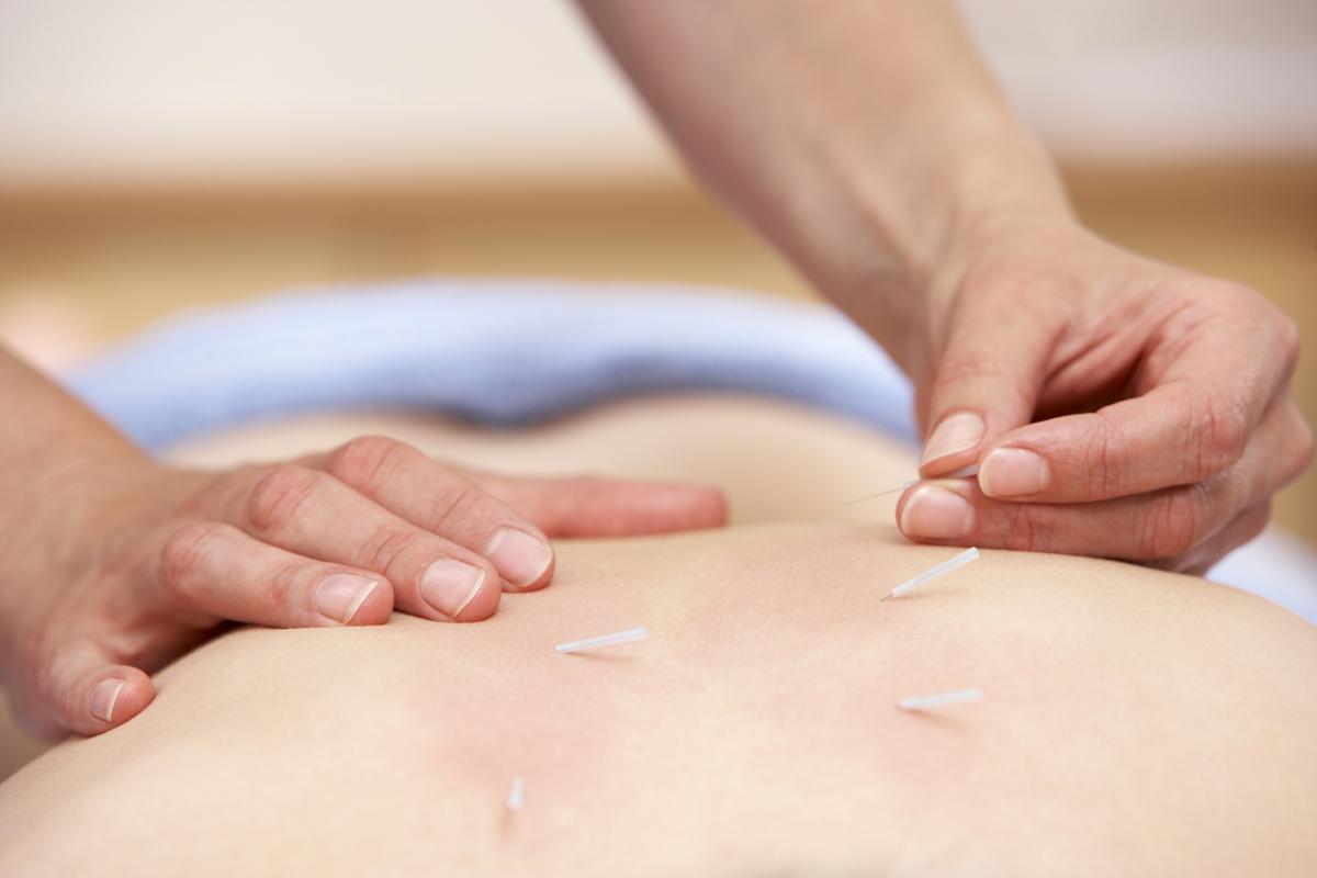 Az akupunktúra néhány igazolt hatása