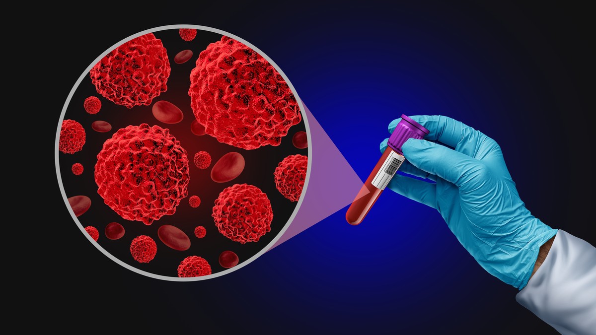 Jedinstveni test krvi koji bi pouzdano otkrivao sve vrste raka još ne postoji