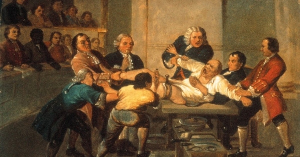 The painful way people had surgery before anaesthesia was developed - Vimarsana News