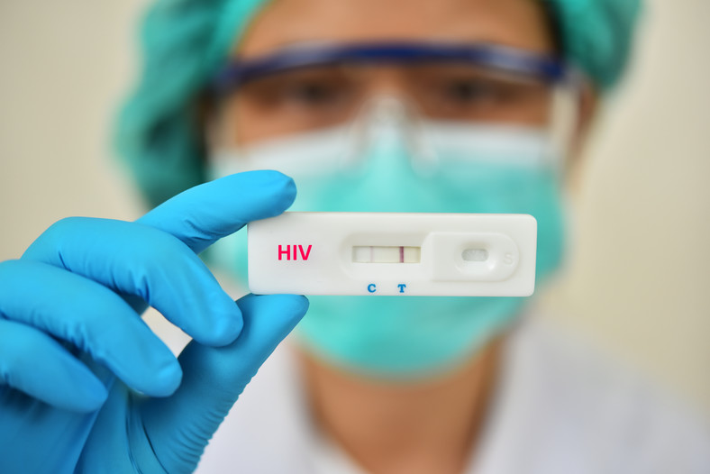 Pracownik medyczny trzymający test na HIV, zdjęcie ilustracyjne.
