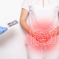 A Crohn-betegség oka, tünetei és kezelési lehetőségei