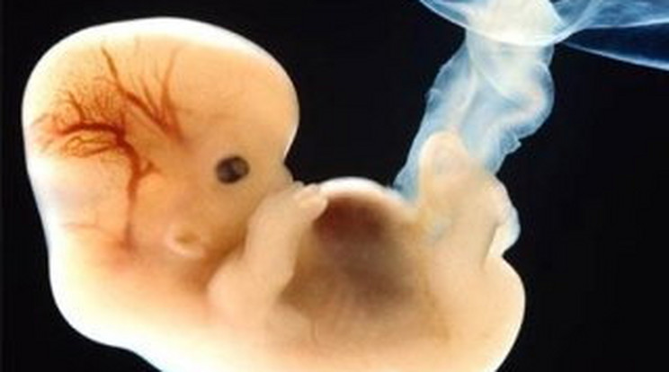 Embrióbotrány