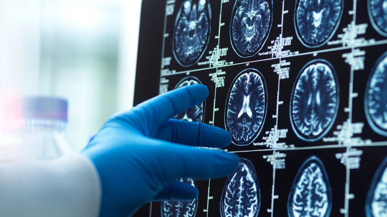 Ak si tieto príznaky všimnete, vyhľadajte pomoc. (ilustračné foto)