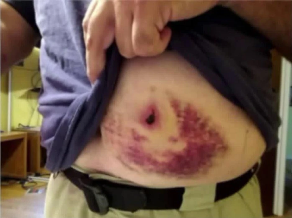 Policajac pokazuje povredu nakon što je pogođen u pancir