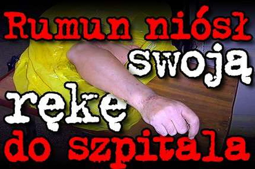 Rumun niósł swoją rękę do szpitala