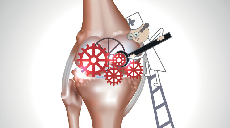 Az ízületi fájdalom megnehezíti a mindennapokat /Fotó: SHUTTERSTOCK