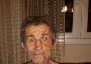 Prebijeni starac Radomir Radojevic selo Liplje01