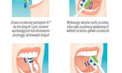 Szczotkowanie zębów - właściwy sposób, częstotliwość wymiany szczoteczki, rodzaje szczoteczek