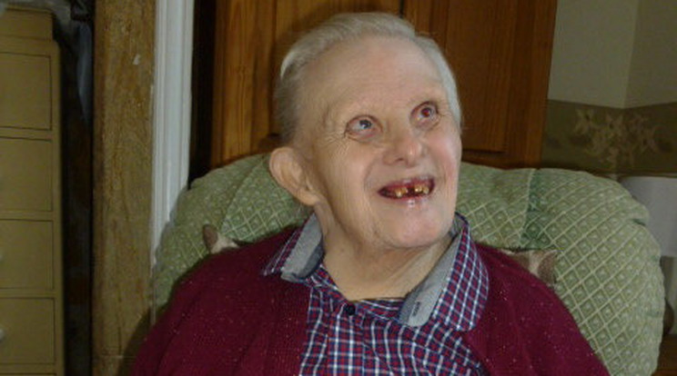 76 éves lett a világ legidősebb Down-szindrómás embere / Fotó: Northfoto