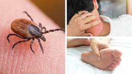 Lyme disease symptoms years after bite.  They quietly exhaust the body