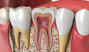  Budowa zęba - jak zbudowany jest ząb? Budowa anatomiczna i histologiczna 