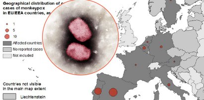 Małpia ospa u ludzi w kilku krajach  Europy – ECDC ocenia sytuację