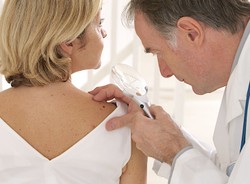 Pieprzyk - przyjaciel czy wróg naszej skóry?