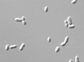 pneumococcus-d00000D02d39c6739ca20