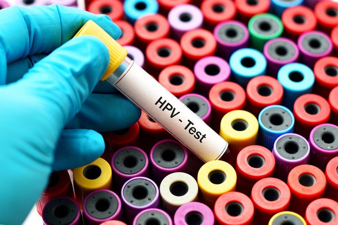 HPV-fertőzés: ezzel az új magyar módszerrel gyógyítanak betegeket