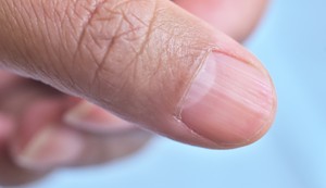 Polumesec na noktima