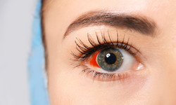 Krople do oczu na alergie - jak działają? Skład i zastosowanie