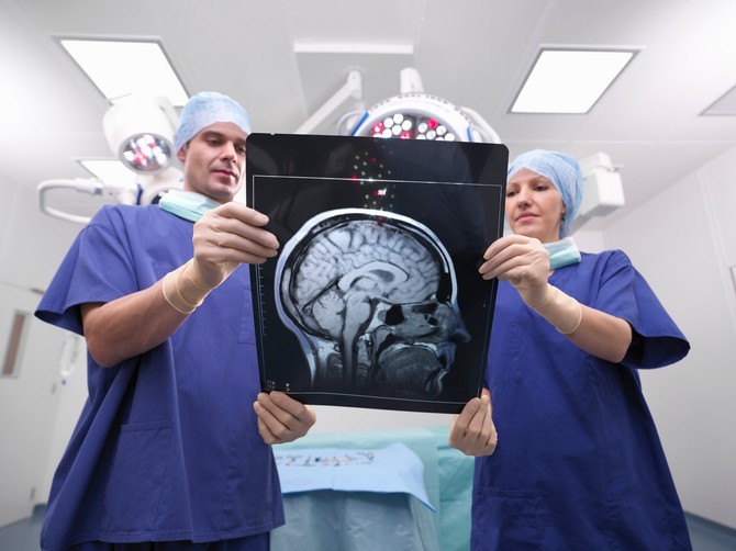Saveti neurologa kako da sačuvate pamćenje