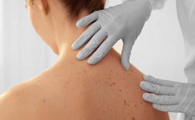 Dermatolodzy: u 20 proc. chorych na Covid-19 pojawiają się zmiany na skórze