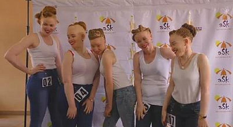 Albinos contestants in Uganda