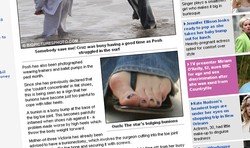 Zobacz stopę Beckham. Uwaga! Jest straszna