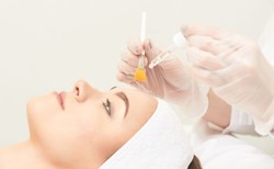 Peelingi chemiczne – remedium na wszelkie problemy skóry?