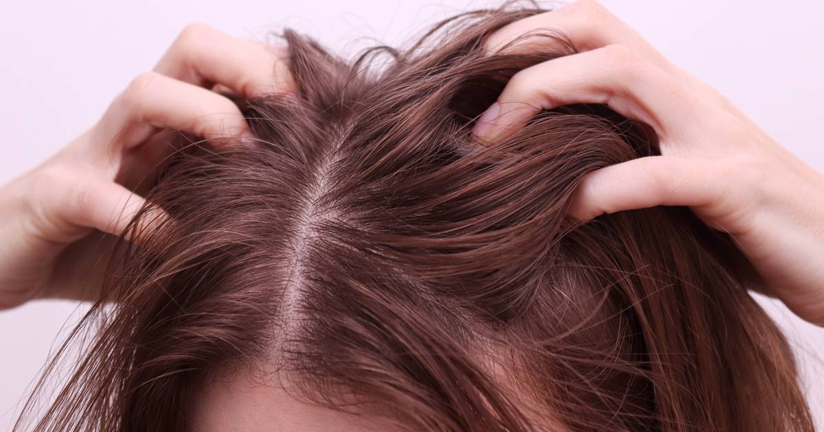 Ten peeling do skóry głowy to bestseller! Oczyszcza skalp, przedłuża świeżość włosów o 3 dni