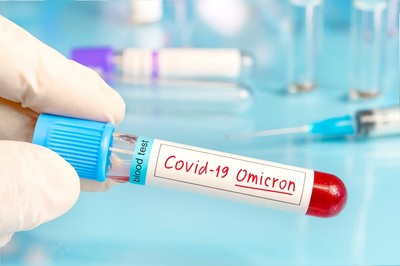 Szef WIM: Wszystko wskazuje na to, że Omikron zmierza do zakończenia pandemii