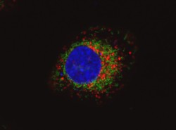 Karta graficzna wykryje raka