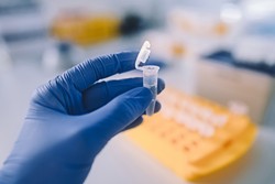 Nowy wirus Langya wyizolowany w Chinach. Patogen może uszkadzać wątrobę i nerki